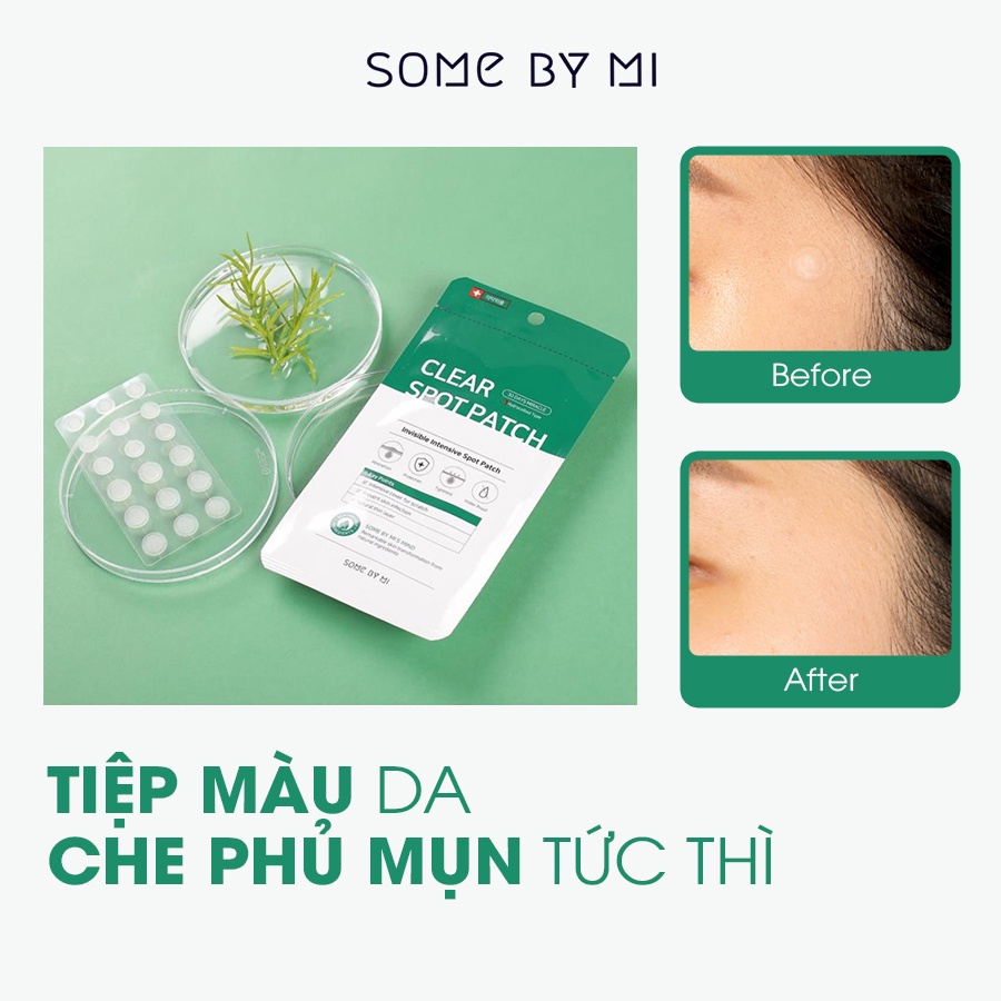 Miếng Dán Mụn Some By Mi Clear Spot Patch (Gói18 Miếng) - Elbi Beauty Cosmetics &amp; Skincare