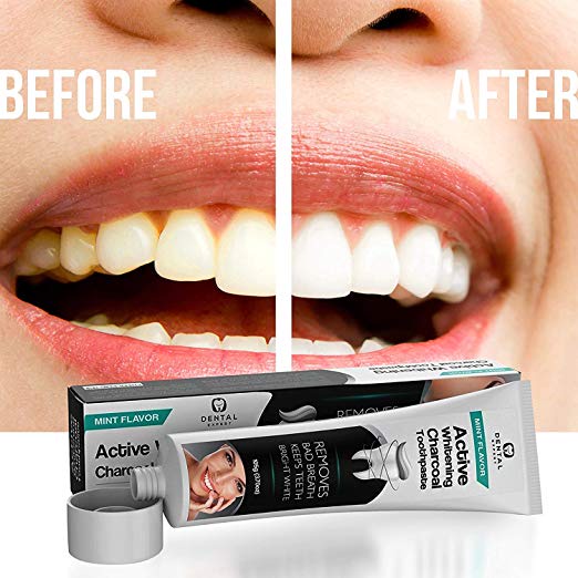 Kem đánh răng siêu trắng Active Whitening thành phần thiên nhiên hỗ trợ làm trắng răng cực hiệu quả cực hot 2021