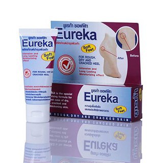 Kem Thoa Hỗ Trợ Nứt Gót Chân Eureka (30g) | BigBuy360 - bigbuy360.vn