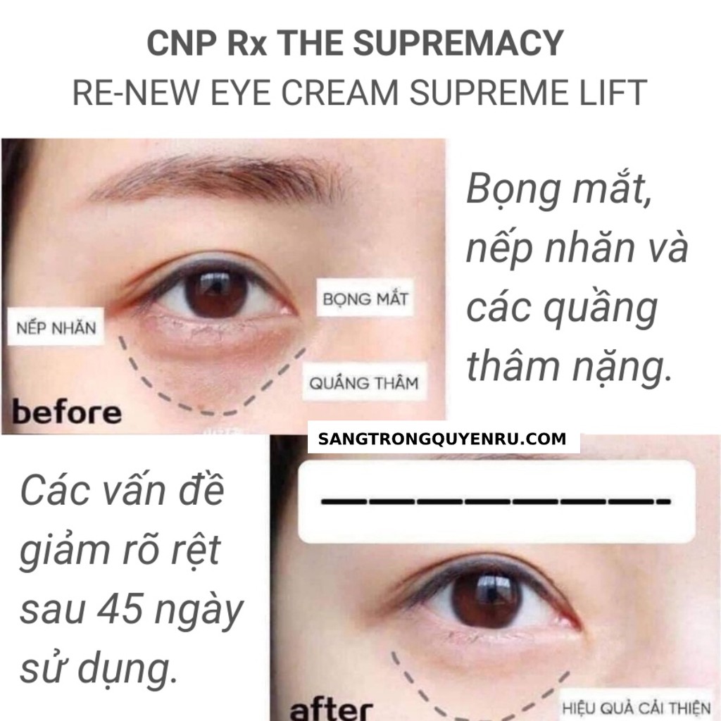 Gói Kem Mắt Cao Cấp CNP Rx The Supremacy Re-New Eye Cream 1ml - Siêu Phục Hồi Lão Hóa Vùng Da Mắt