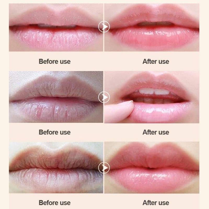 [HIISEES] Mặt nạ môi hoa hồng dưỡng ẩm mềm môi căng mọng Rose Moisturizing Lip Mask | BigBuy360 - bigbuy360.vn