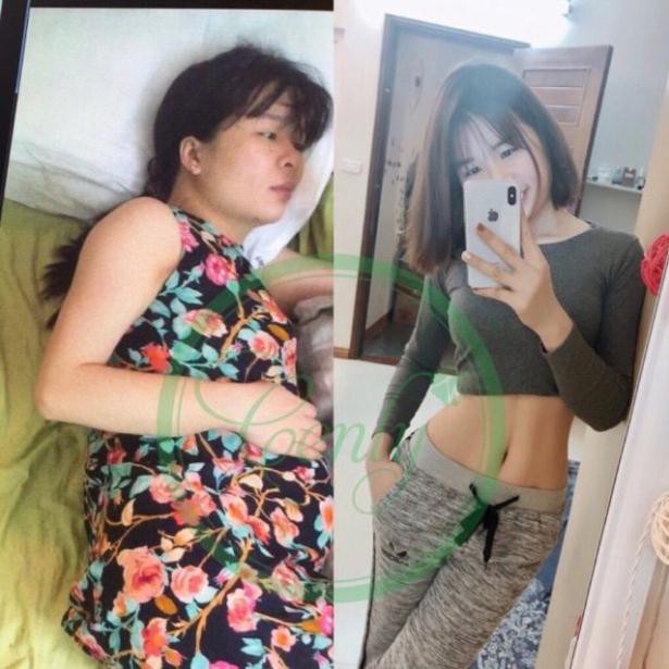 Combo Giảm Cân Mẹ Sữa Và Kem Tan Mỡ | BigBuy360 - bigbuy360.vn