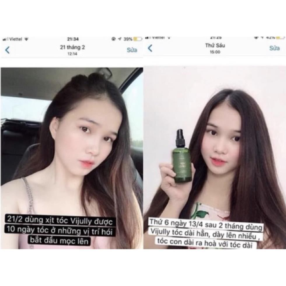 Tinh Dầu Bưởi ViJully Kích Thích Mọc Tóc, Trị Rụng Tóc ❤️ FREESHIP ĐƠN 150K + QUÀ TẶNG | BigBuy360 - bigbuy360.vn
