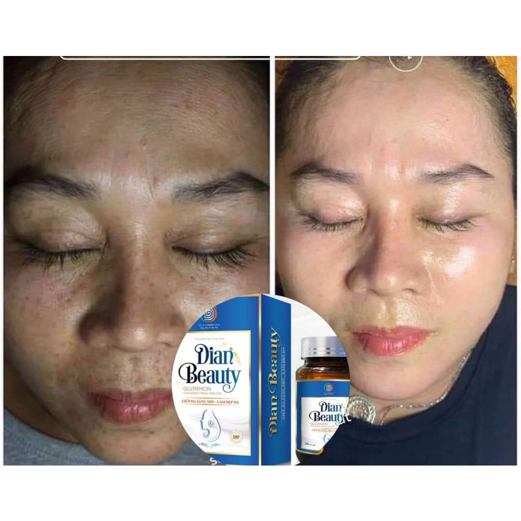 Viên Uống Trắng Da Dian Beauty, [Mua 1 Tặng 2] ,Mua 2 Giảm thêm 59K, FreeShip, Trắng toàn thân, mờ nám | Thế Giới Skin Care