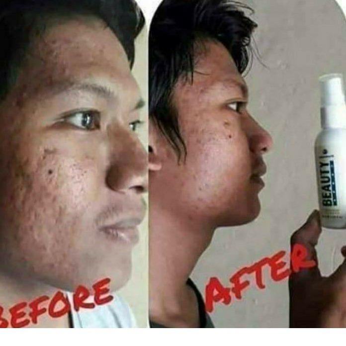 ! Tấm trải giường phun sương làm đẹp mã-288 Natura thế giới 10 | BigBuy360 - bigbuy360.vn