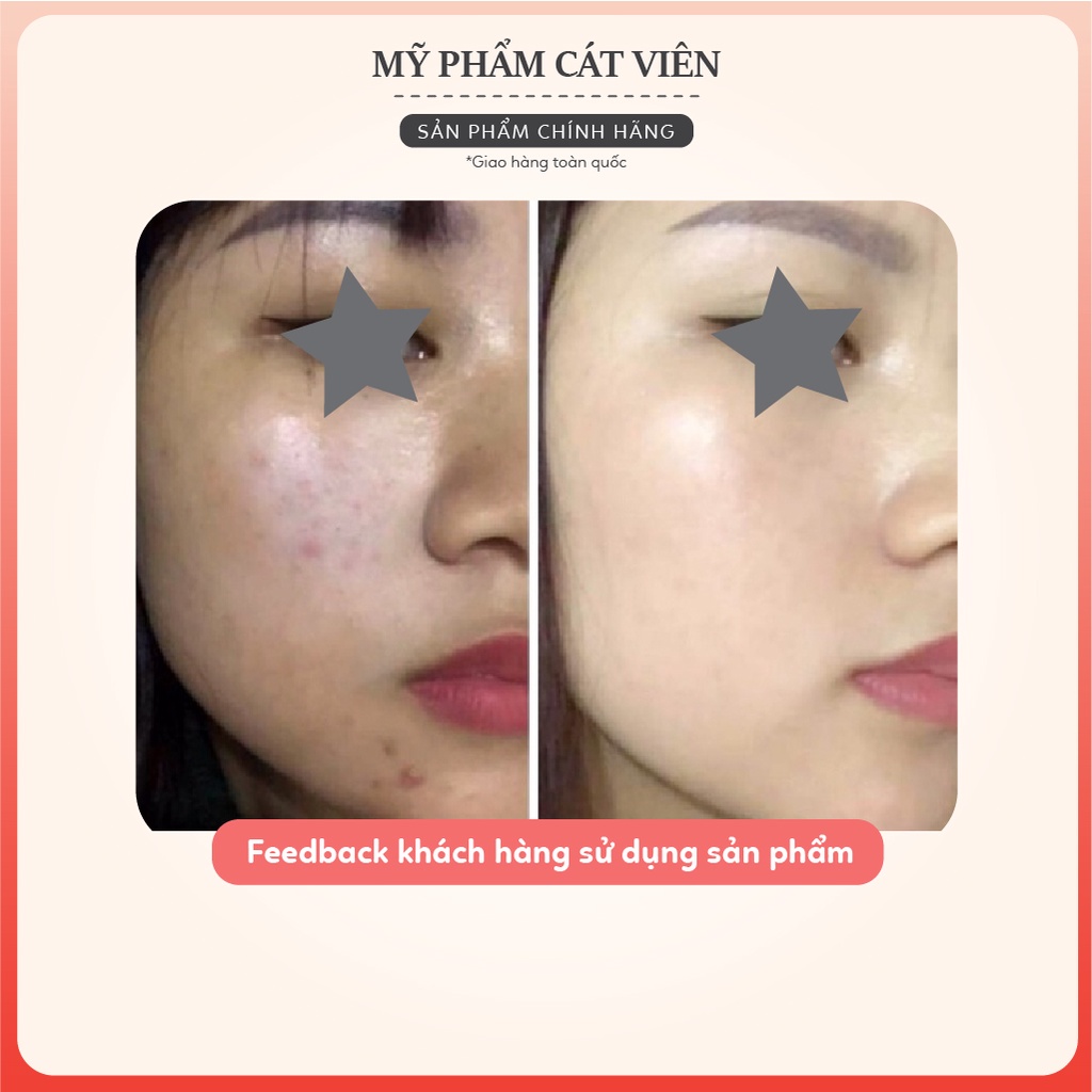 Serum cá hồi kiềm dầu, giảm mụn, trắng da, se khít lỗ chân lông, hết thâm mụn Salmon DN Brightening Medicell