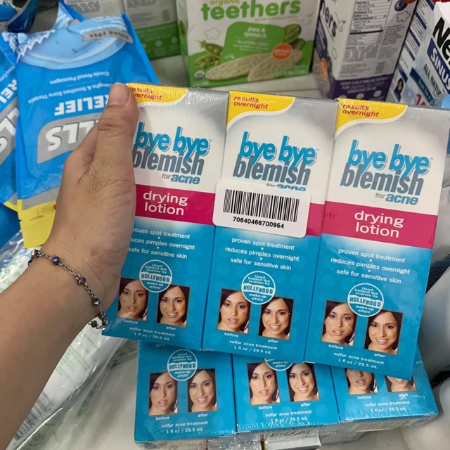 Lotion trị mụn Bye Bye Blemish