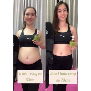 Kem Tan Mỡ GoSlim (Tặng đai nịt bụng)