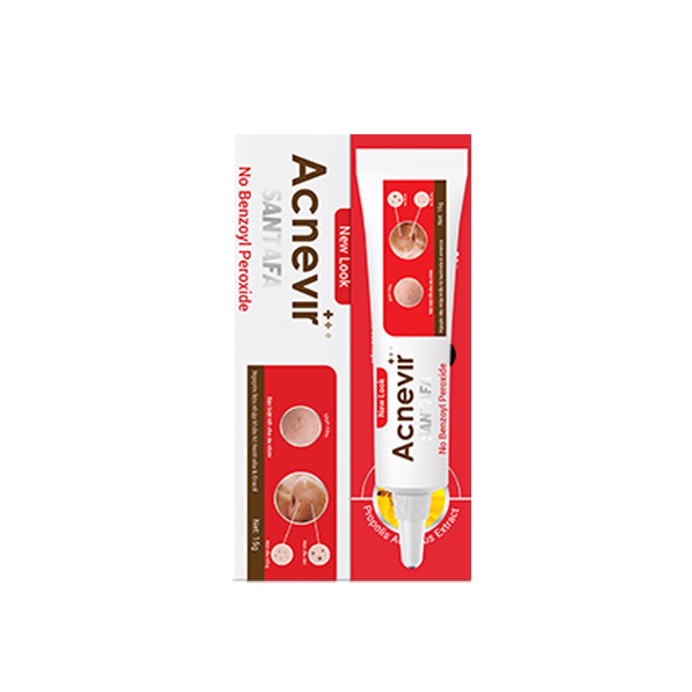 Combo Sạch Mụn ACNEVIR SANTAFA Sữa Rửa Mặt 100g + Kem Giảm Mụn Đầu Đen 15gr (Đỏ)