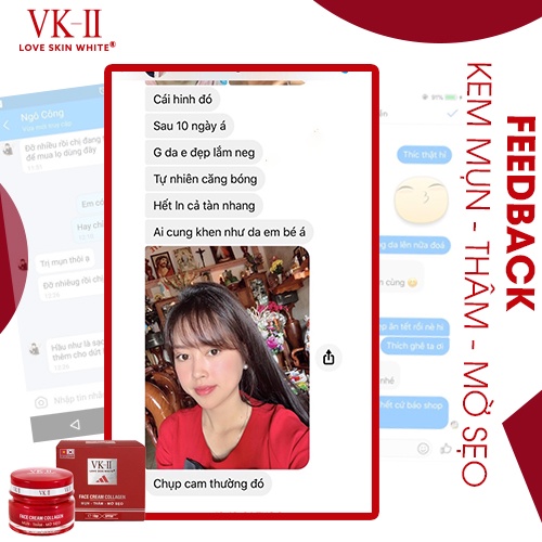 Kem dưỡng da giảm mụn thâm mờ sẹo VK-II Love Skin White Face Cream Collagen 10g