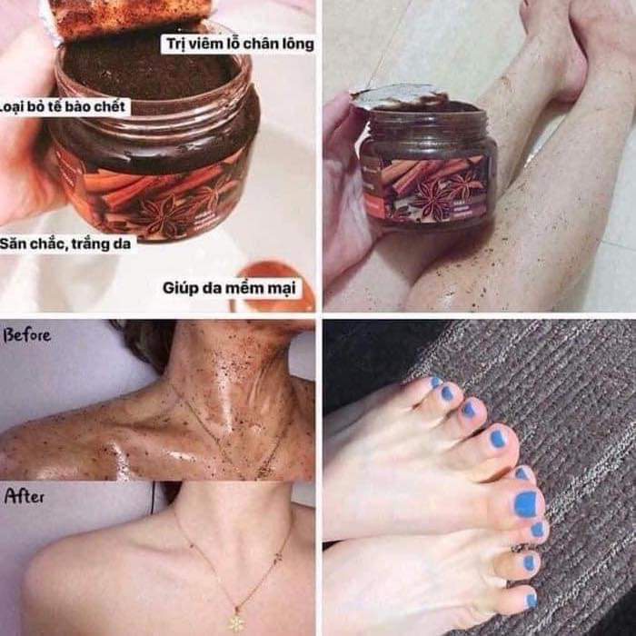 Tẩy da chết Quế hồi của Nga 380g, Tẩy da chết an toàn hiệu quả HN23 | BigBuy360 - bigbuy360.vn