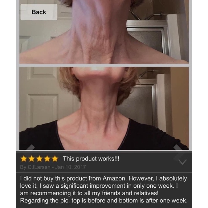 Kem dưỡng săn da cổ, vùng dưới cổ Gold Bond fullsize 56g