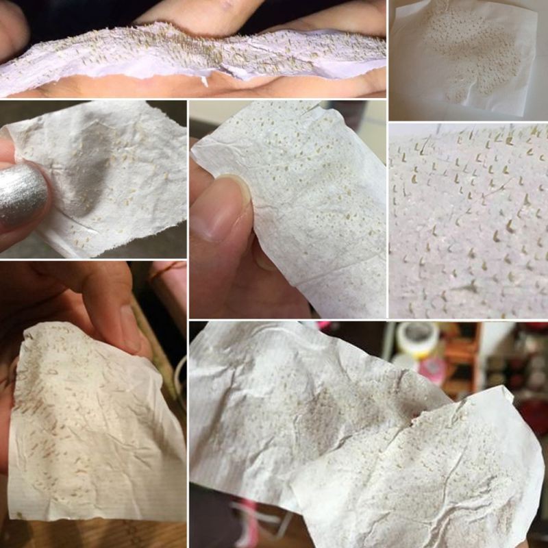 Gel dán lột mụn đầu đen LANBENA