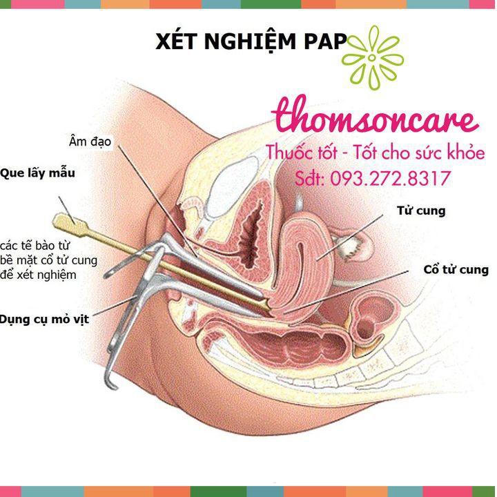 Combo 10 Mỏ vịt khám phụ khoa cho nữ giới, mỗi cái bằng nhựa y tế trong túi tiệt trùng, vệ sinh