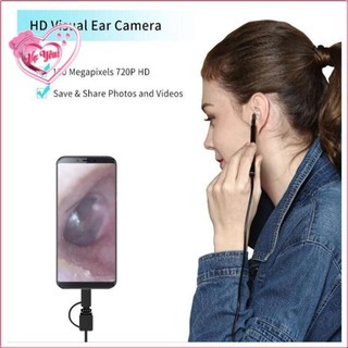 Bộ Ráy Tai Có Camera Nội Soi HD Visual Earpick