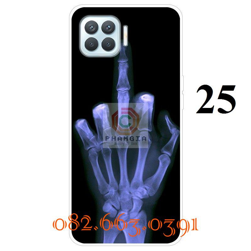 Ốp lưng Oppo A93 dẻo in hình dễ thương (p3)
