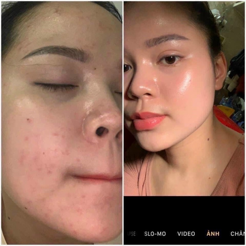 Tuýp 30ml Retinol Repair phục hồi da không gây bong tróc ,tái tạo trẻ hoá da