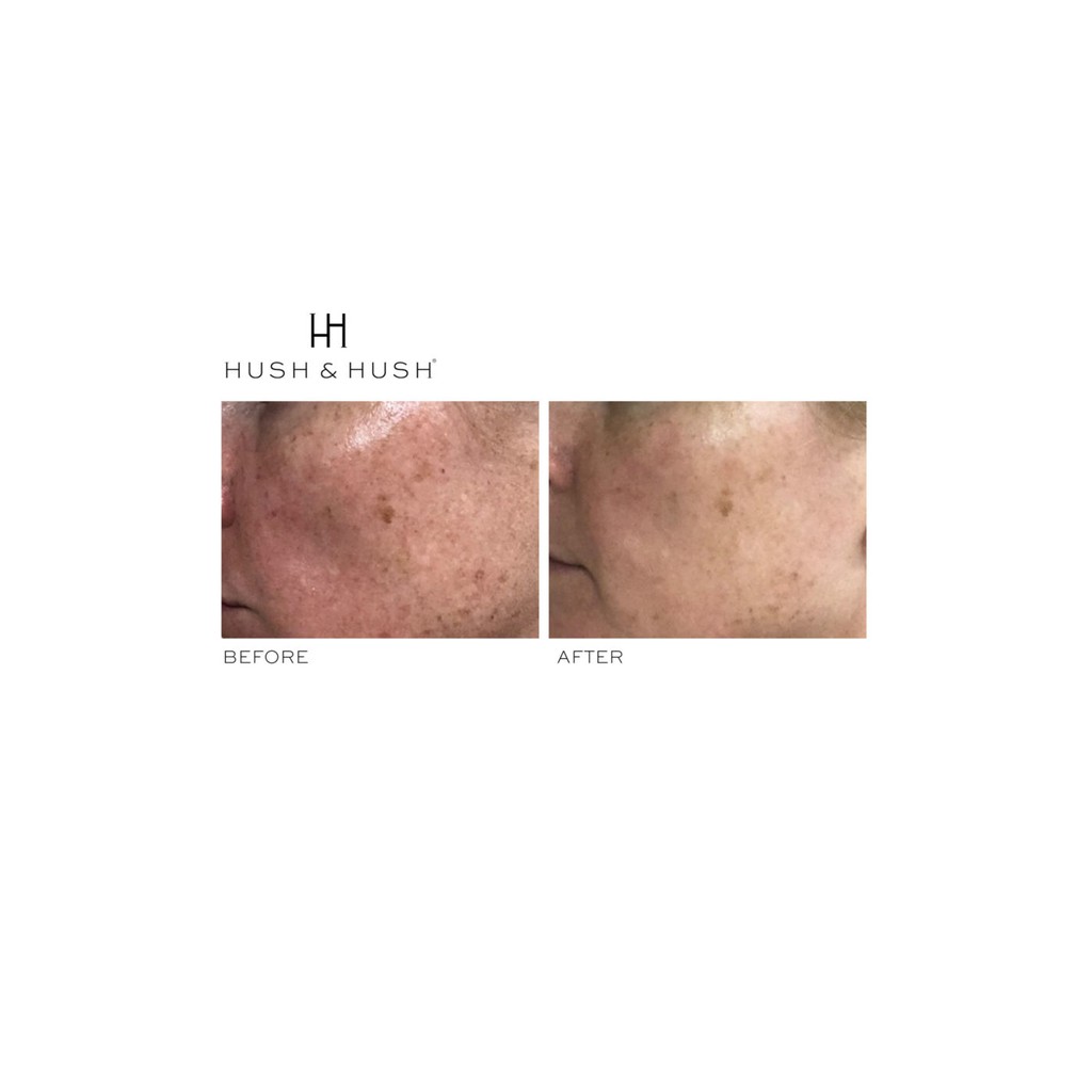 Viên uống làm sáng da và mờ thâm nám Image Skincare Hush &amp; Hush Skin Capsule Brighten+ 60 viên