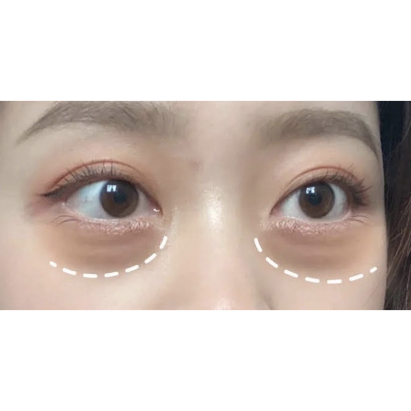 Kem mắt mờ thâm xóa nhăn,Bọng Mắt Thái Lan 5ml