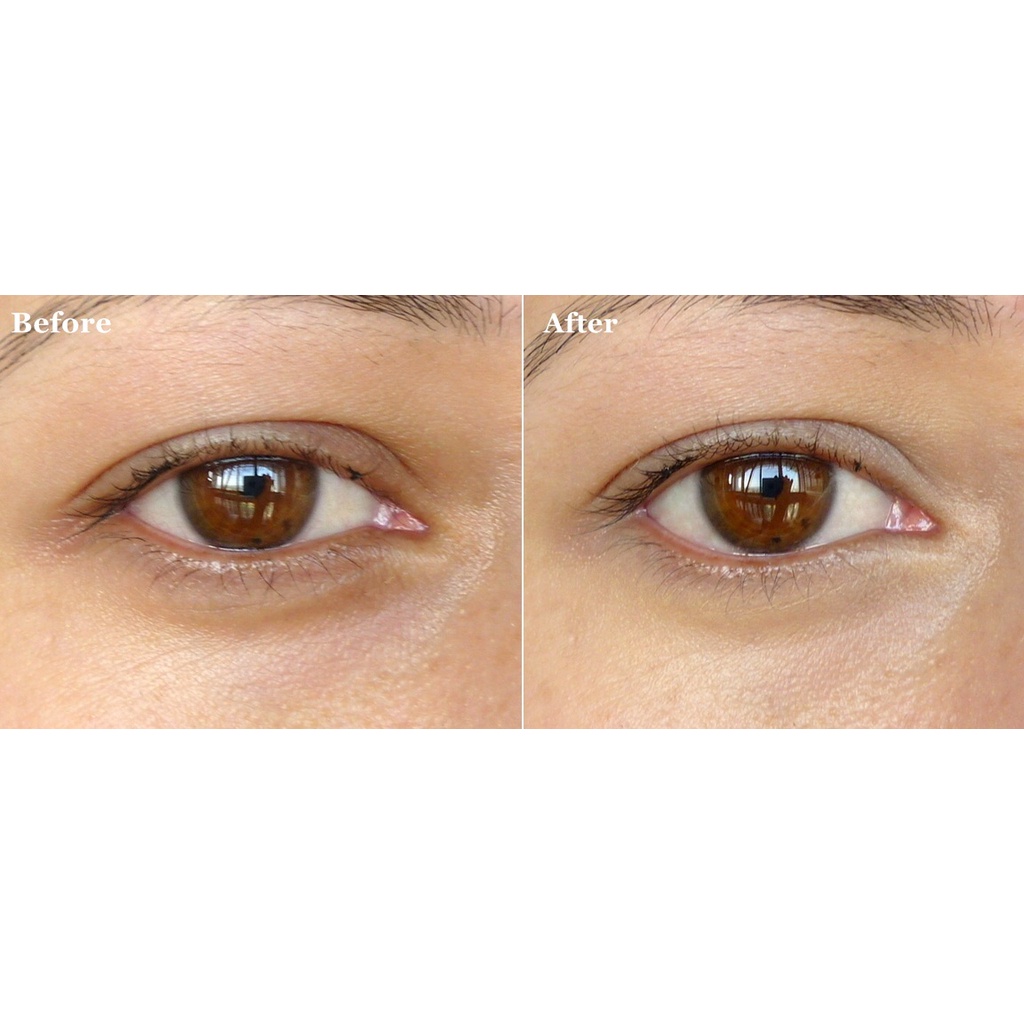 Thanh lăn dưỡng mắt Garnier Eye Roller 15ml fullbox