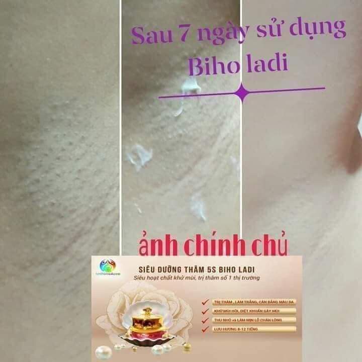Siêu Dưỡng Thâm BIHOLADI [ cam kết chính hãng] | BigBuy360 - bigbuy360.vn