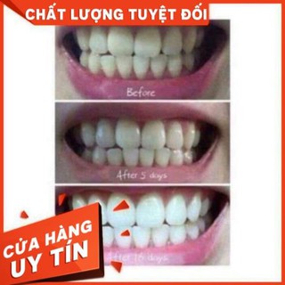 Trắng răng T WHITE