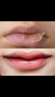 Ủ môi - dưỡng môi mềm như ý