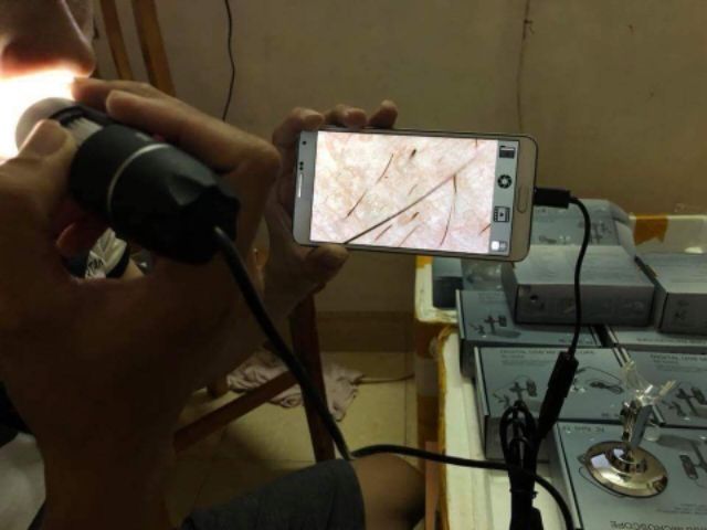 Máy soi da mini kết nói điện thoại máy tính