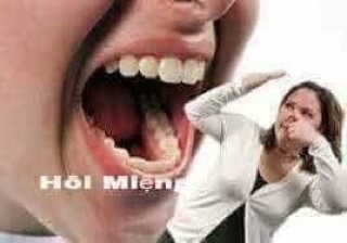 Kem đánh trắng răng