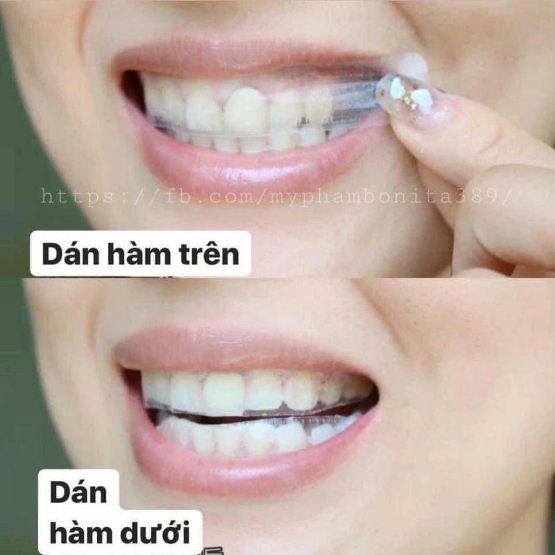 Miếng Dán Trắng Răng 3D Giúp Trắng Răng