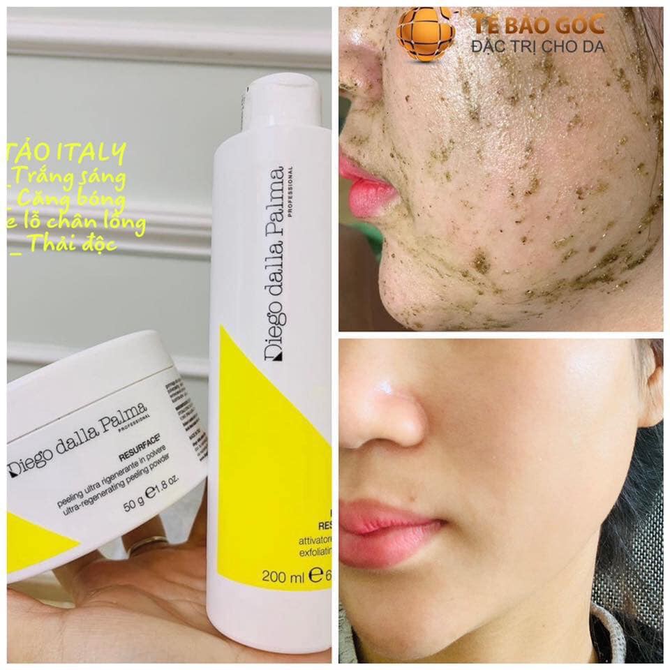 tảo gai biển Diego Dalla Palma