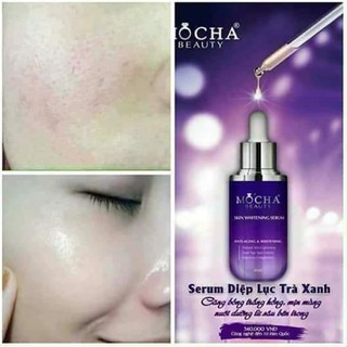 SERUM DIỆP LỤC MOCHA