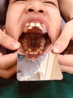 GƯƠNG CHỈNH NHA