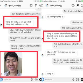 [Sốc] Máy tẩy trắng răng Nhật Bản