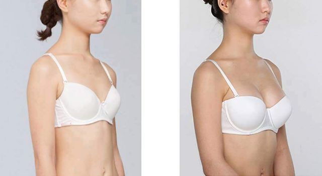 Kem massage nâng ngực | BigBuy360 - bigbuy360.vn