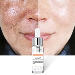 Dung Dịch Salicylic Acid Kiểm Soát Dầu Loại Bỏ Mụn Đầu Đen Thu Nhỏ Lỗ Chân Lông VIBRANT GLAMOUR