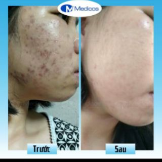 Sữa rửa mặt Medicos Deep Cleanser