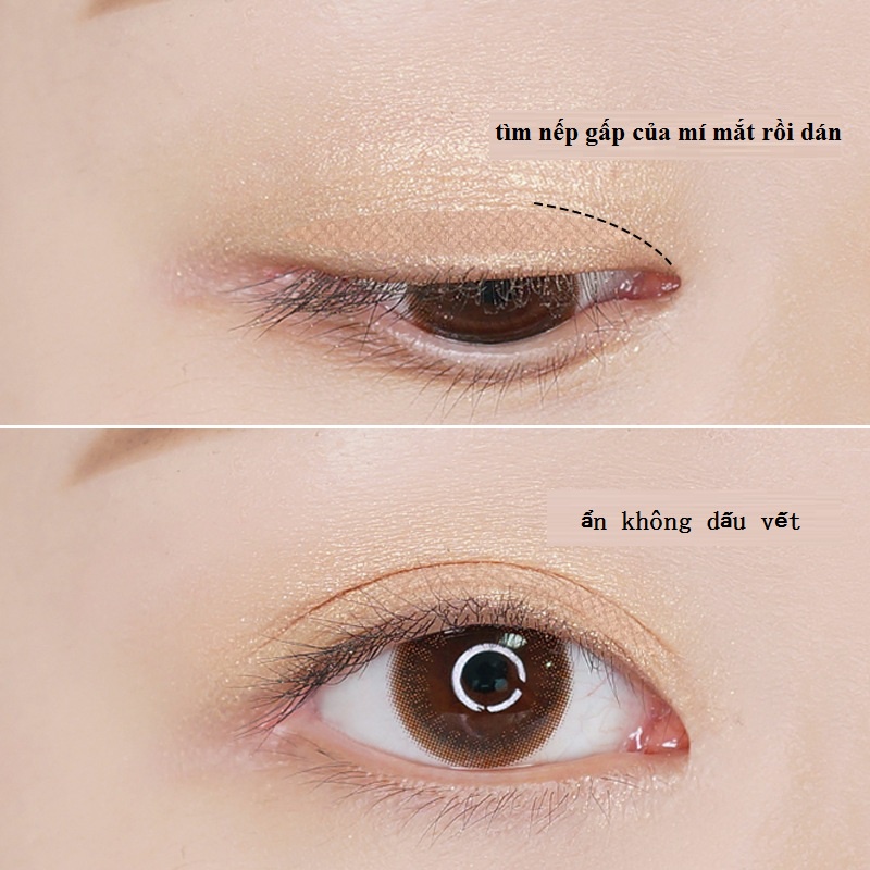 MIẾNG DÁN KÍCH MÍ KEO Y TẾ AN TOÀN HIỆU QUẢ KHẮC PHỤC NHƯỢC ĐIỂM SỤP MÍ, 1 MÍ ĐEM LẠI CHO BẠN ĐÔI MẮT TO TRÒN LẤP LÁNH