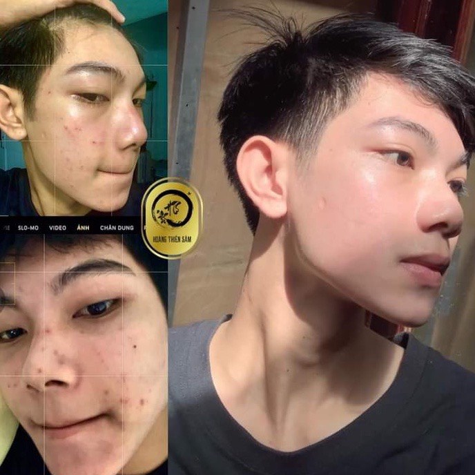 Serum Hoàng Thiên Sâm Loại Thường 3 Chai