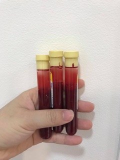 Ống PRP dùng trong spa