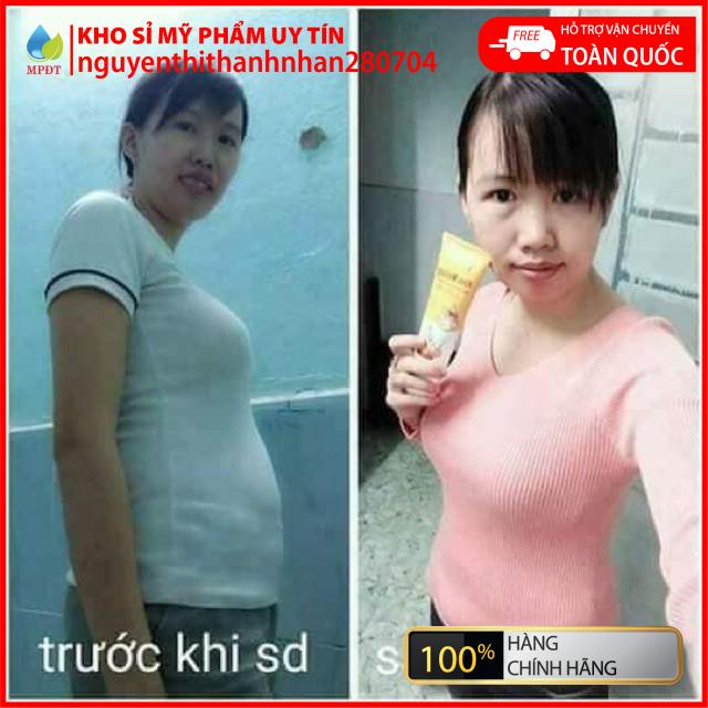 Kem Tan Mỡ Ngân Bình Gừng Ớt 150g .hàng chuẩn công ty