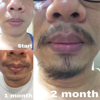 Thuốc mọc râu lông tóc Snor thai lan