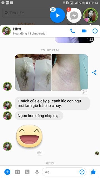 TRIỆT LÔNG NÁCH AN LÀNH