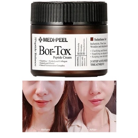 Serum và Kem Dưỡng MEDI-PEEL Bor-Tox Da Căng Bóng Chống Lão Hoá