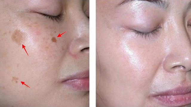 [Tem Chính Hãng] Kem làm mờ vết nám ,trắng sáng da SVR clairial peel night 30ml