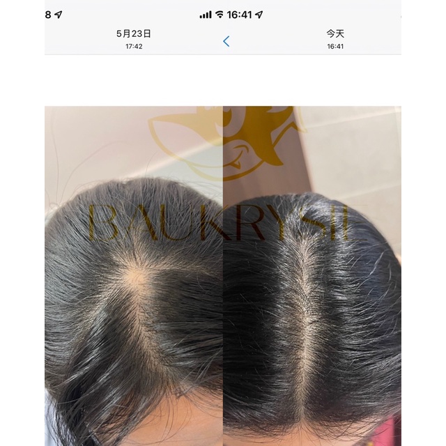 PRO POMELO Hair Mist - Xịt Mọc Tóc 3 Loại Tinh Dầu (Vỏ Bưởi, Trà Xanh, Bạc Hà) Và Vitamin B5.