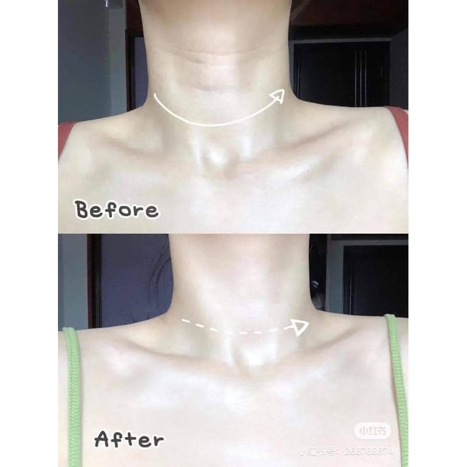 Kem cổ medi peel naite thread 100ml | BigBuy360 - bigbuy360.vn