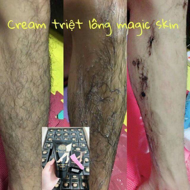 KEM TẨY LÔNG MAGIC SKIN | BigBuy360 - bigbuy360.vn