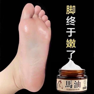 Kem Ngựa Nứt Gót Chân Hiệu Quả K Ngờ