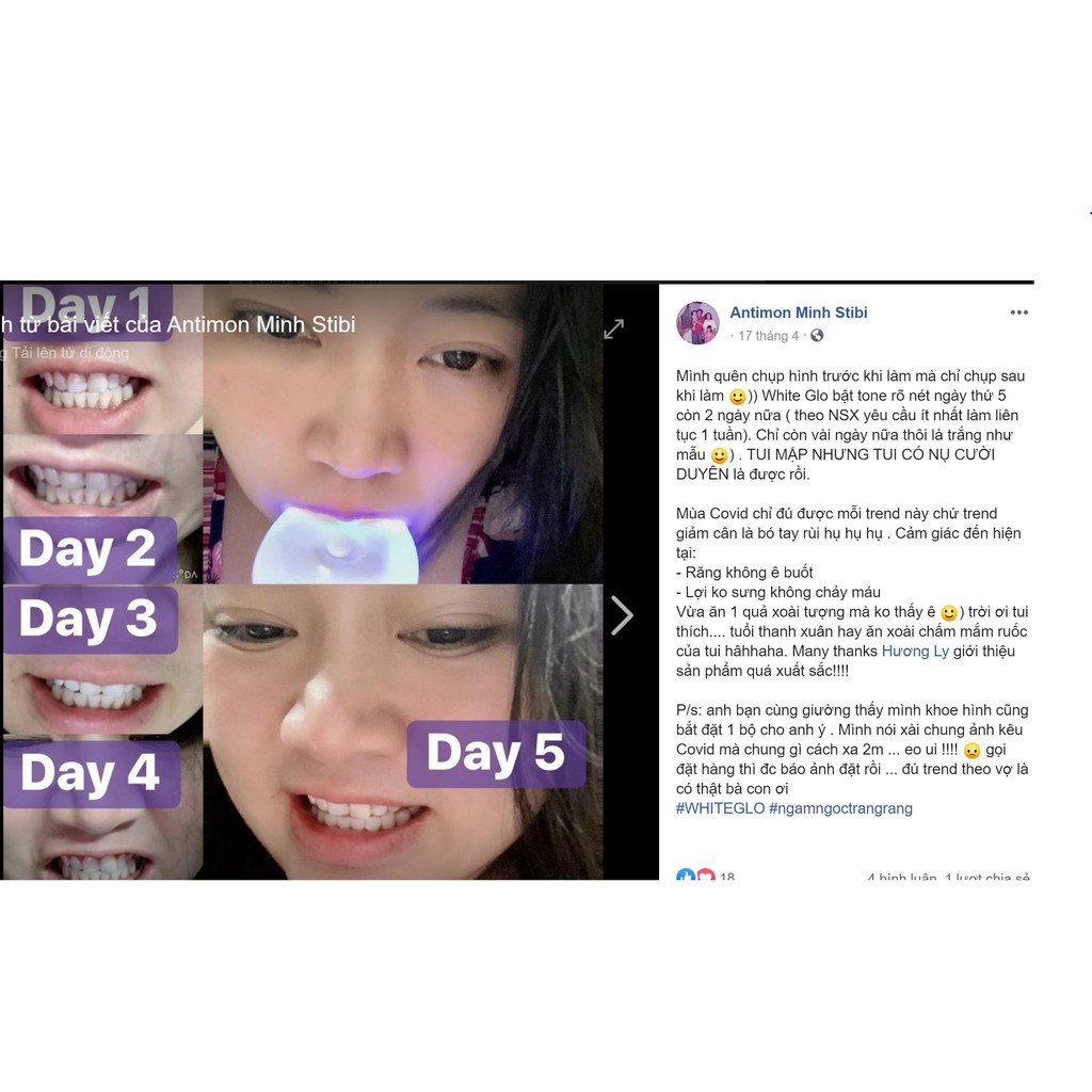 [ Úc hàng có sẳn] Máy làm trắng răng bằng ánh sáng xanh White Glo White Accelerator Blue Light Teeth Whitening System